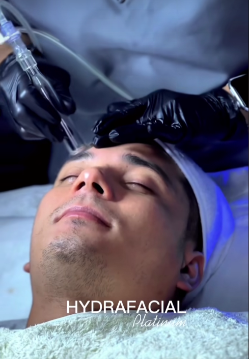 HYDRAFACIAL